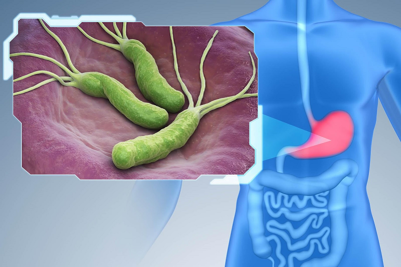 Viêm dạ dày ruột gây lên chủ yếu do các vi khuẩn, virus