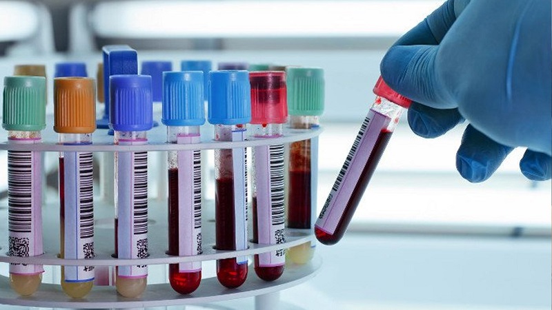 MEDLATEC cung cấp dịch vụ xét nghiệm sốt xuất huyết tại nhà ở Khánh Hòa