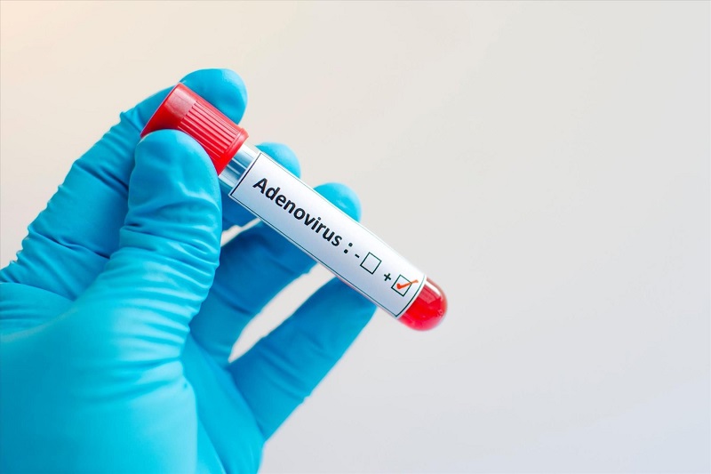 Viêm đường hô hấp Adenovirus có thể lây lan gián tiếp thông qua đồ dùng của người nhiễm virus