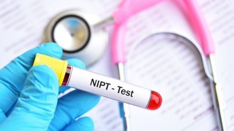 Bác sĩ thường chỉ định phụ nữ mang thai thực hiện NIPT test