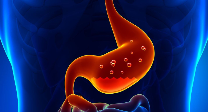 Viêm dạ dày cấp tính chủ yếu do nhiễm vi khuẩn Helicobacter pylori gây ra