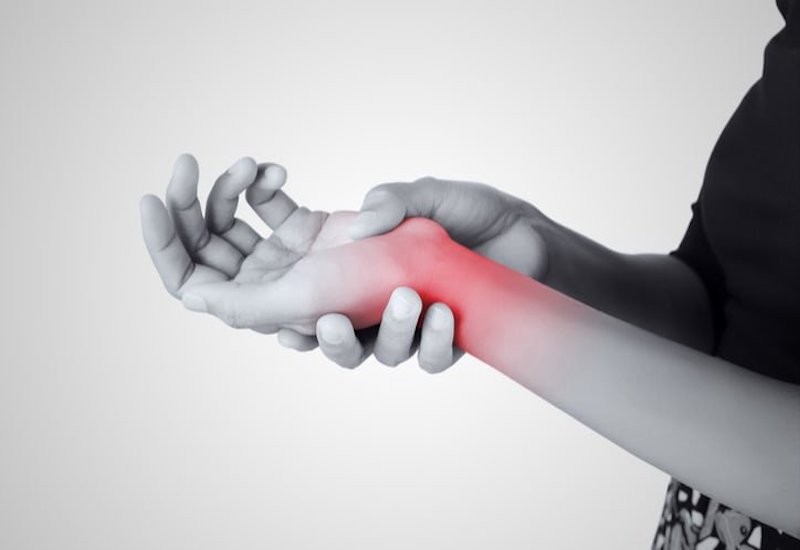 Suy giảm vận động do hội chứng ống cổ tay được xem là dạng bệnh đơn dây thần kinh diễn ra phổ biến nhất