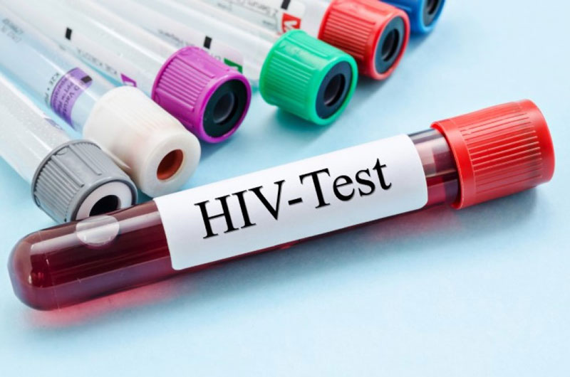 Chúng ta có thể tham khảo dịch vụ xét nghiệm HIV tại nhà Nghệ An
