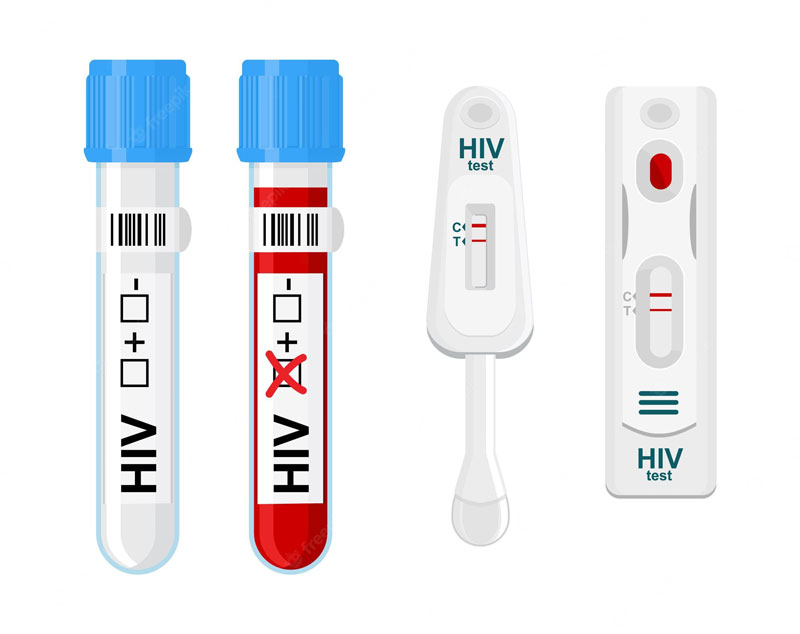 MEDLATEC cung cấp những dịch vụ HIV Nghệ An nào?