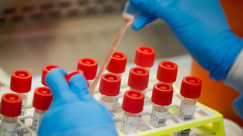 Xét nghiệm HIV AB test có chính xác hay không là thắc mắc của rất nhiều người 