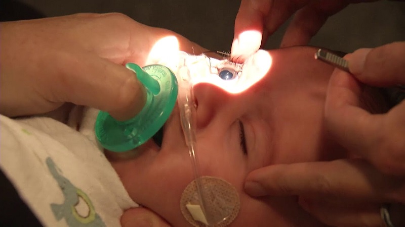 Thăm khám có thể phát hiện và điều trị sớm các vấn đề về mắt ở trẻ sơ sinh