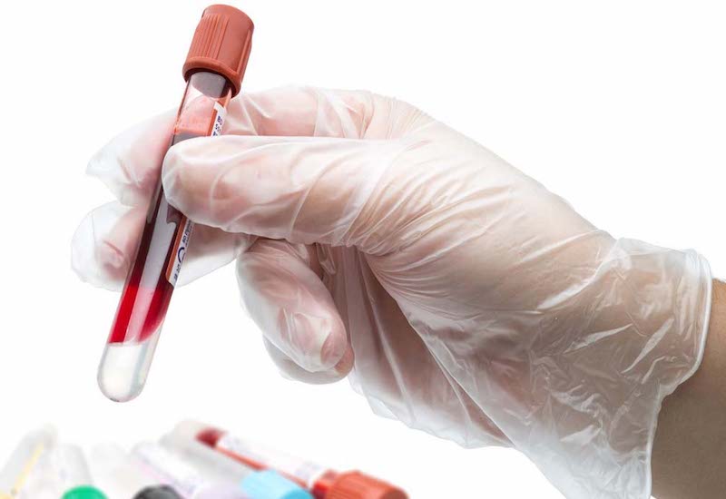 Xét nghiệm máu có ý nghĩa quan trọng trong việc phát hiện ra những loại bệnh lý tiềm ẩn 