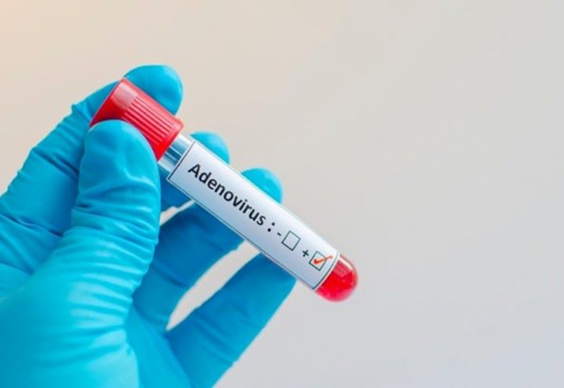 Cách duy nhất khẳng định chính xác người bệnh có nhiễm Adenovirus hay không là xét nghiệm