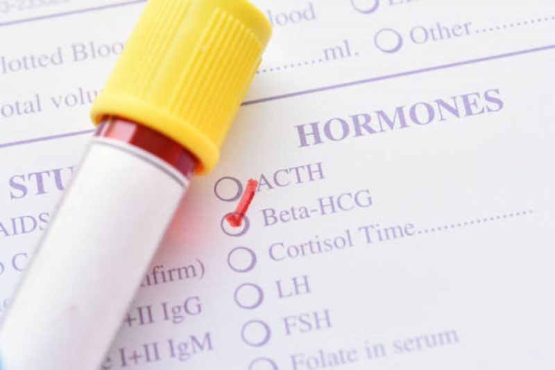 Xét nghiệm beta HCG giúp bác sĩ biết được người phụ nữ có mang thai hay không