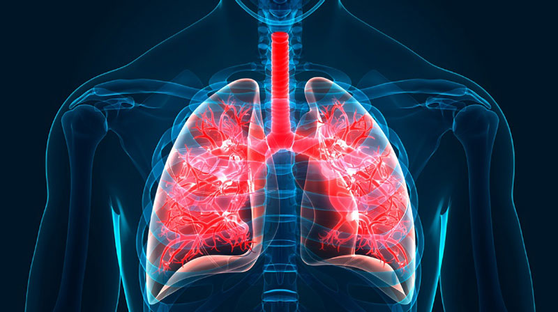 Đôi nét tổng quan về bệnh xơ hóa phổi