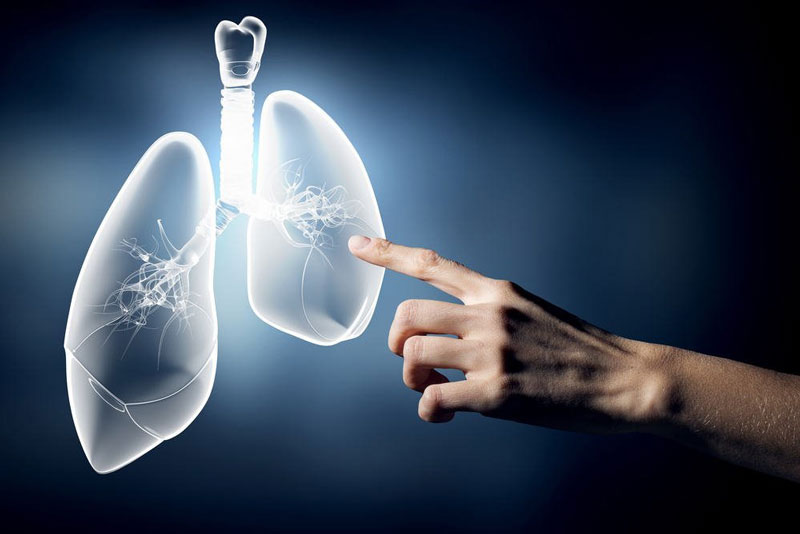 Viêm phổi là một trong biến chứng nguy hiểm của bệnh xơ hóa phổi