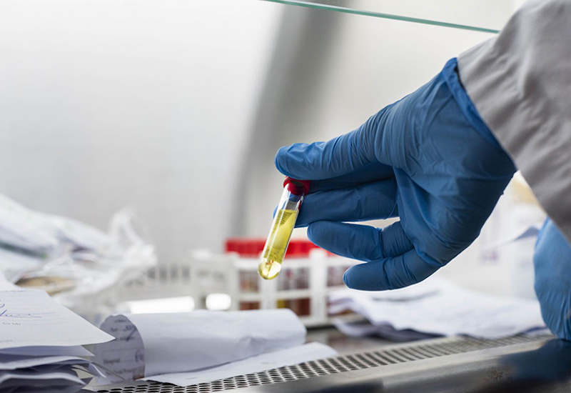 Xét nghiệm là phương pháp duy nhất giúp xác định một người liệu đã nhiễm virus cúm A hay chưa