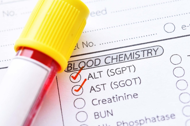 Xét nghiệm chỉ số AST và ALT giúp xác định mức độ hoại tử của tế bào gan