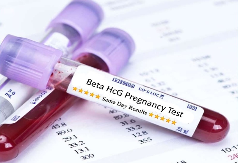  Xét nghiệm beta HCG giúp chị em nhận biết mang thai từ rất sớm