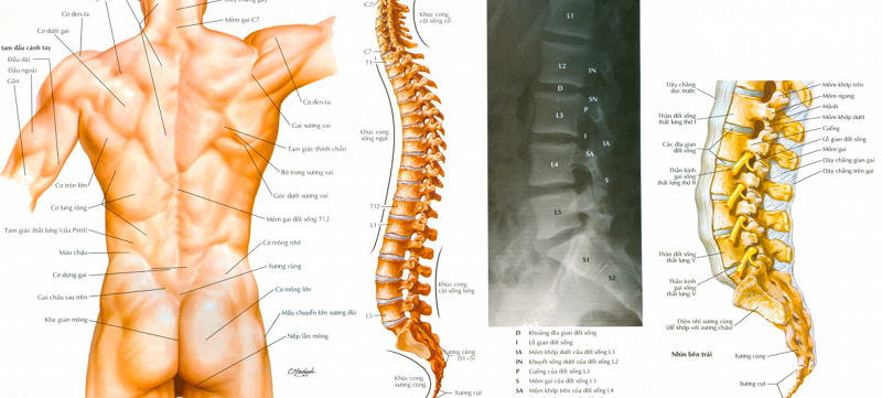 Hội chứng thắt lưng hông ảnh hưởng trực tiếp đến rễ thần kinh của đốt sống thắt lưng