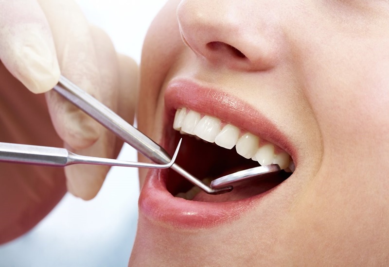 Nên thăm khám răng trước khi quyết định áp dụng các phương pháp tẩy trắng răng