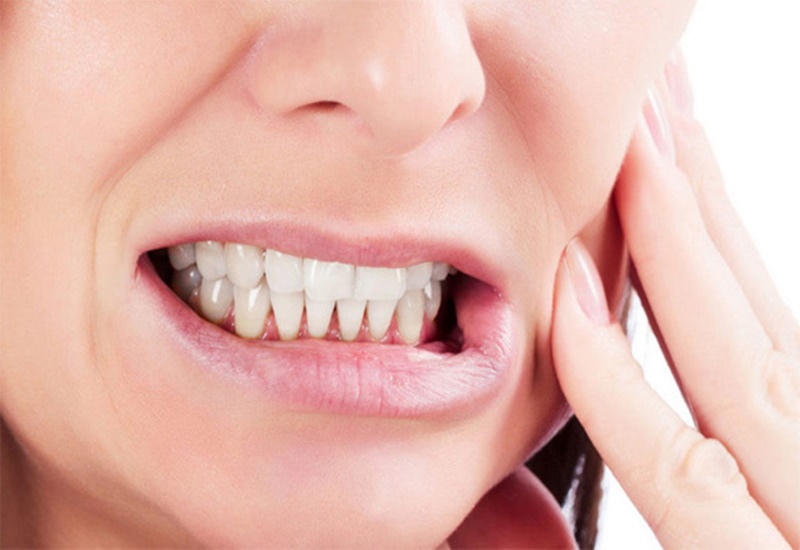  Khi nghiến răng, hai hàm răng của người bệnh sẽ cắn chặt lại