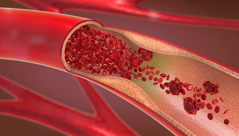 Tiểu cầu có vai trò hết sức quan trọng đối với quá trình đông máu