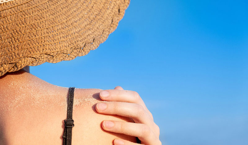 Tiếp xúc với ánh nắng mặt trời quá lâu có thể khiến da bạn bị tổn thương