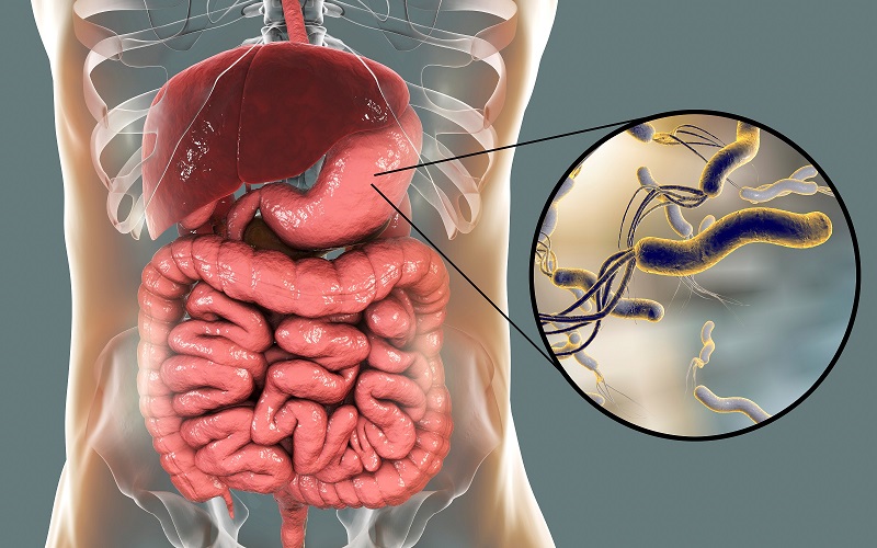 Vi khuẩn HP dạ dày hoàn toàn có khả năng lây nhiễm từ người bệnh sang người lành