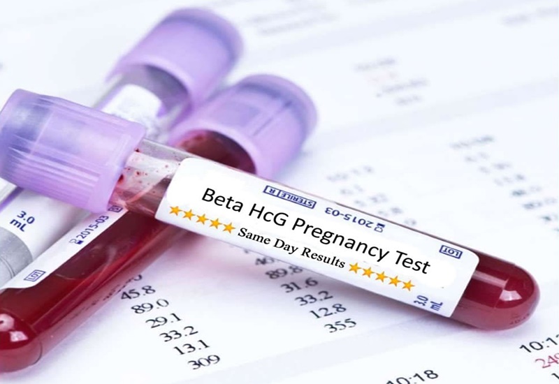Xét nghiệm beta HCG giúp chị em xác định tình trạng mang thai