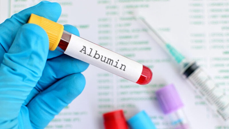 Chỉ số Albumin dùng trong đánh giá chức năng gan