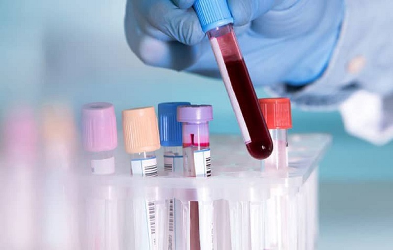 Dịch vụ xét nghiệm sinh hóa máu Bắc Ninh có thể thực hiện nhiều xét nghiệm chỉ số theo yêu cầu