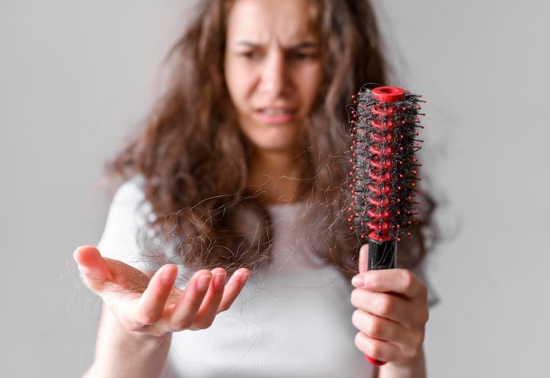Thường xuyên căng thẳng mệt mỏi cũng là nguyên nhân dẫn đến rụng tóc