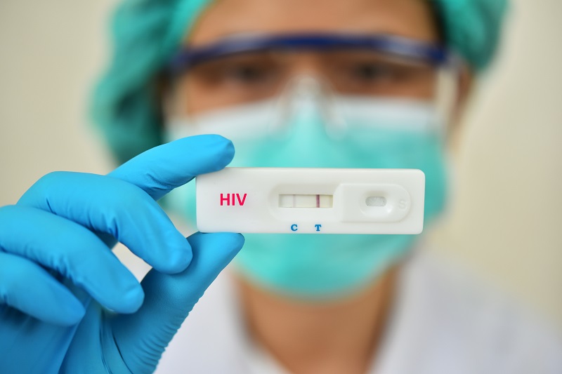 Test nhanh HIV là phương pháp được sử dụng phổ biến hiện nay