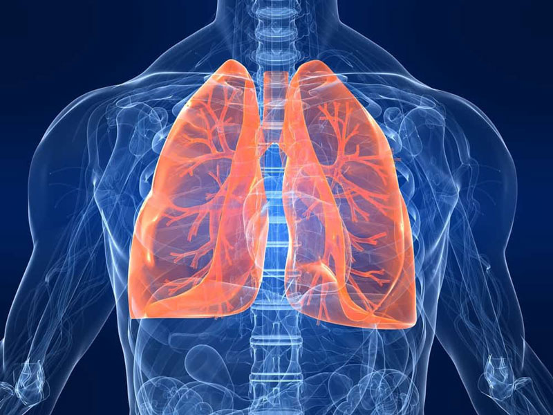Bệnh nhân lao màng phổi không nên chủ quan