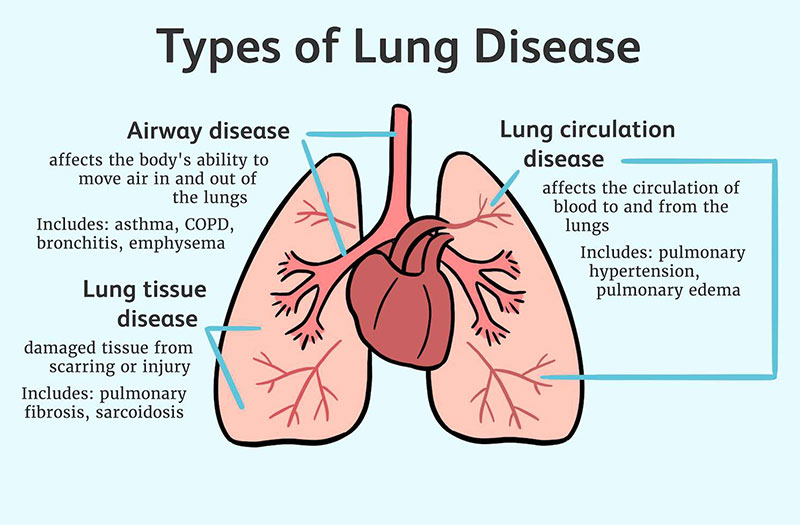 Chức năng của phổi có thể bị đe dọa bởi nhiều tác nhân