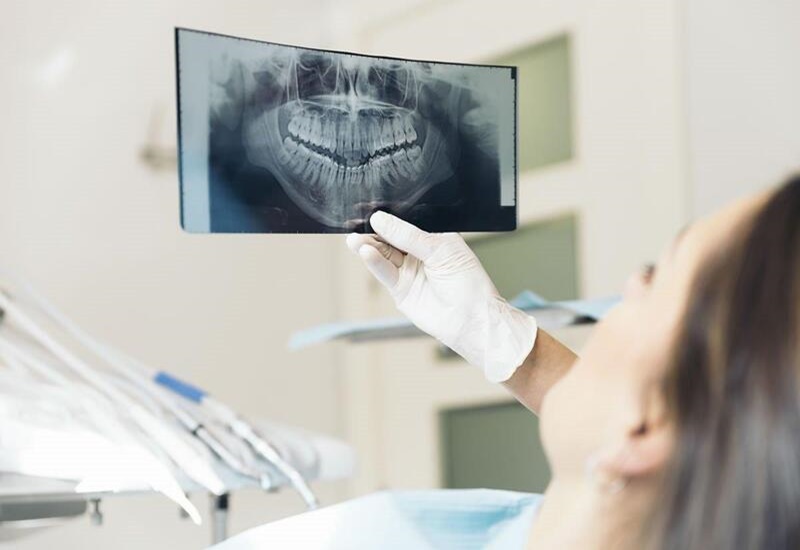 Chụp X-quang để kiểm tra sức khỏe răng miệng