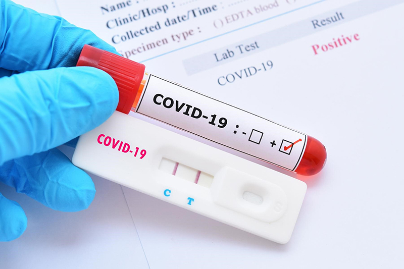 Xét nghiệm phát hiện virus Covit-19 