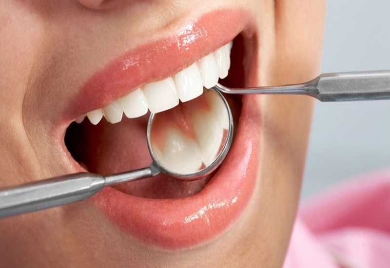 Khám sức khỏe răng miệng định kỳ để phòng tránh bệnh tật
