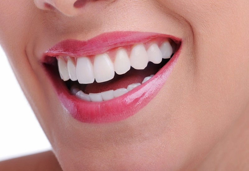 Răng đẹp tự nhiên sau phẫu thuật