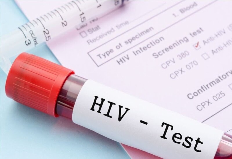 Một số đối tượng nên làm xét nghiệm HIV 