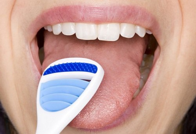 Cạo lưỡi giúp tiêu diệt đáng kể những vi khuẩn ở lưỡi