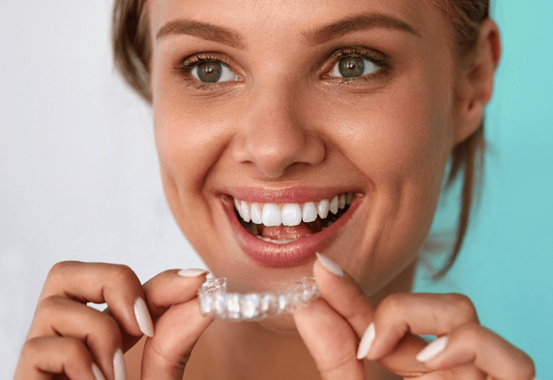 Niềng răng trong suốt đem lại hiệu quả chỉnh nha tương đương như phương pháp khác