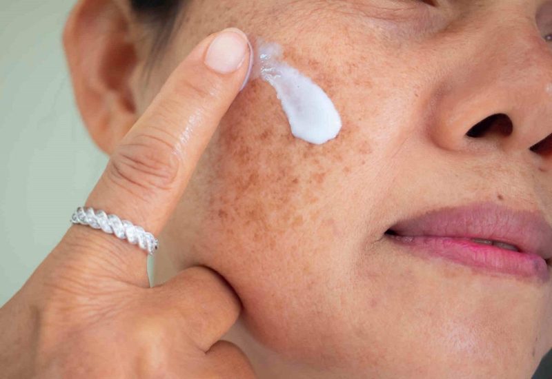 Ngoài thuốc trị nám, bạn cũng cần dùng kem dưỡng ẩm và bảo vệ da mặt bằng kem chống nắng