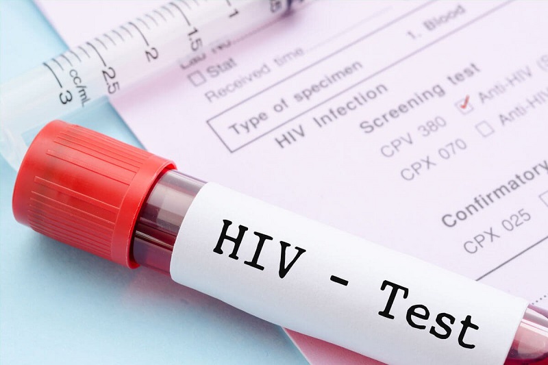 Test nhanh HIV