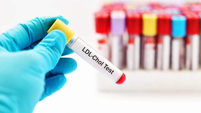 Xét nghiệm LDL cholesterol trong máu