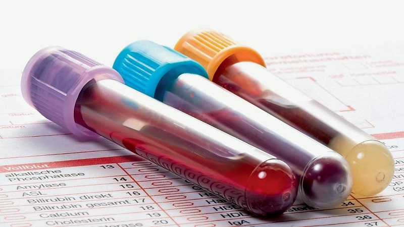 Chỉ số Hematocrit giúp đánh giá tình trạng hồng cầu trong máu