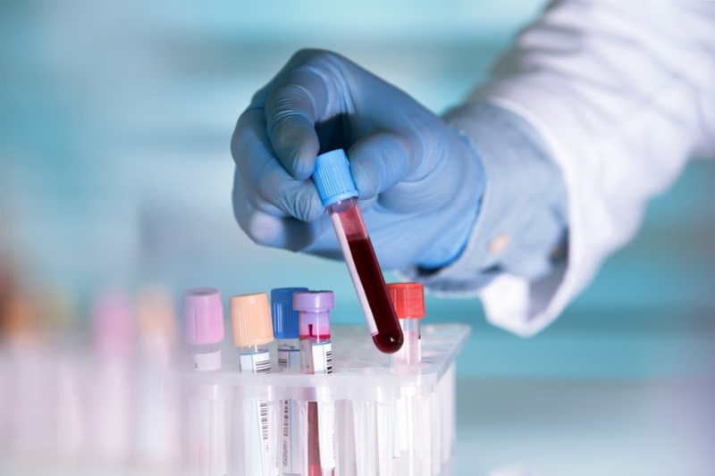 Thực hiện xét nghiệm máu giúp phát hiện tình trạng giảm bạch cầu 