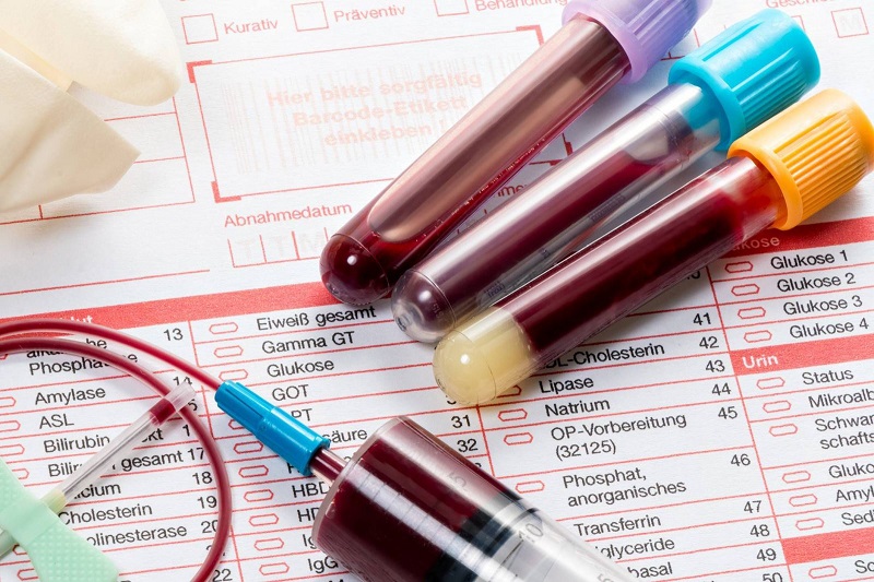 MEDLATEC cung cấp dịch vụ xét nghiệm máu Cần Thơ uy tín và chất lượng