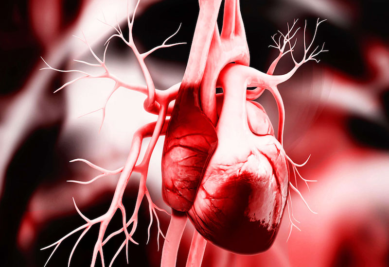 Mắc các bệnh lý về tim mạch là yếu tố hàng đầu dẫn đến nguy cơ đột tử