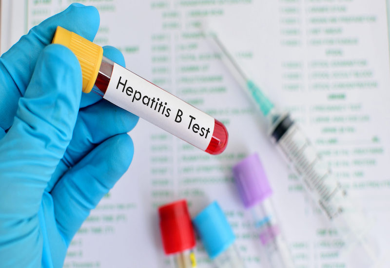 Test viêm gan B là phương pháp quan trọng giúp phát hiện bệnh ngay từ giai đoạn sớm