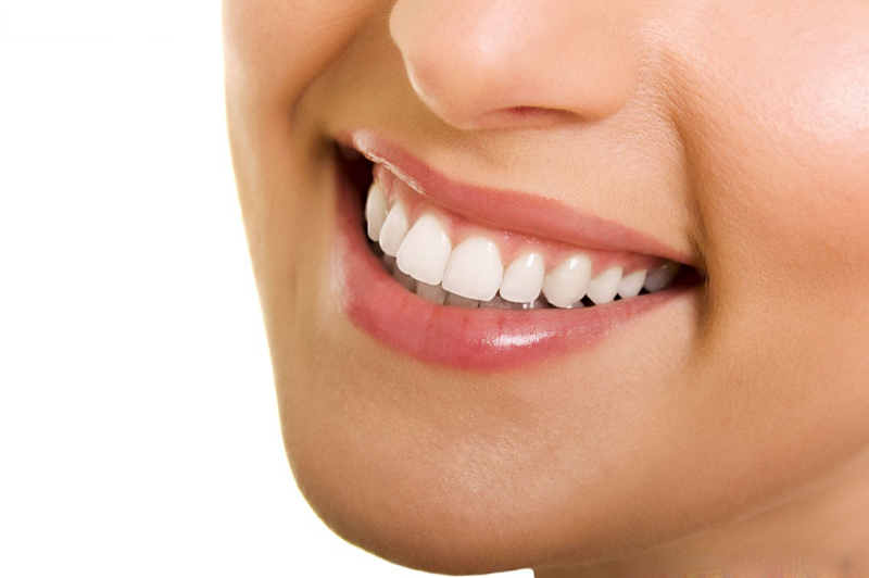 Bọc răng sứ là giải pháp để sở hữu nụ cười tự tin với hàm răng trắng sáng