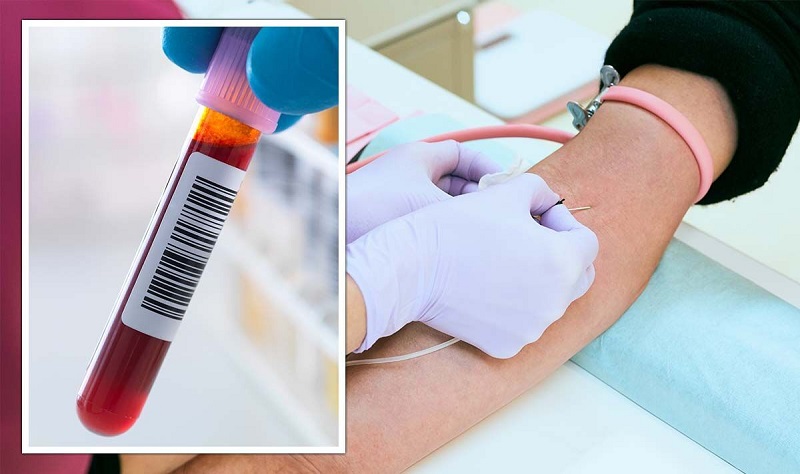 Xét nghiệm máu góp phần chẩn đoán hội chứng suy giảm miễn dịch