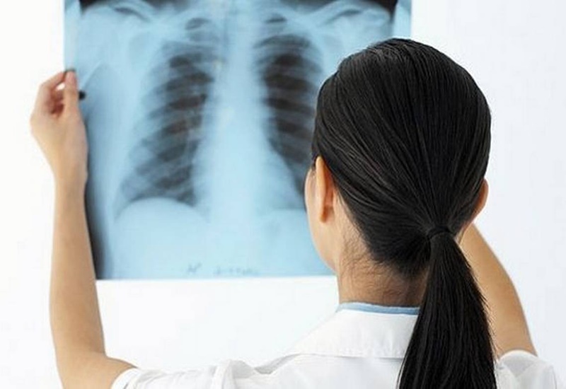 Chụp X-quang để nhận biết rõ tổn thương phổi