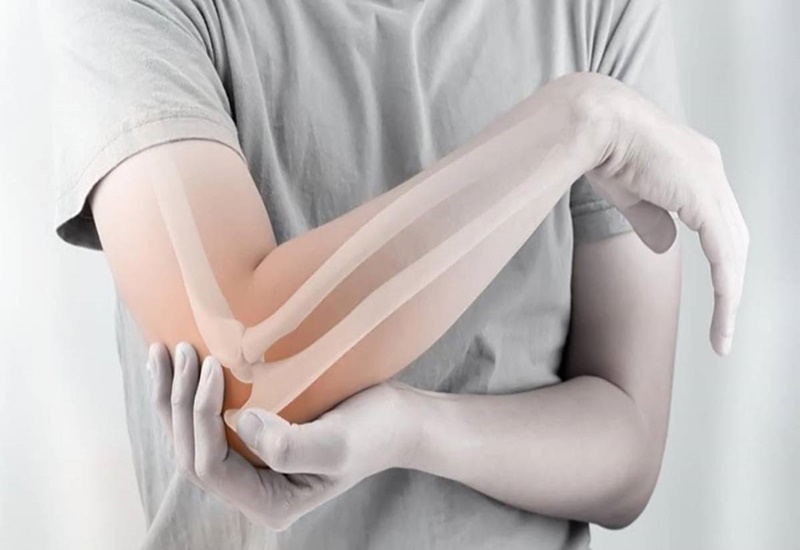 Gãy xương gây đau và giảm khả năng vận động vùng cẳng tay